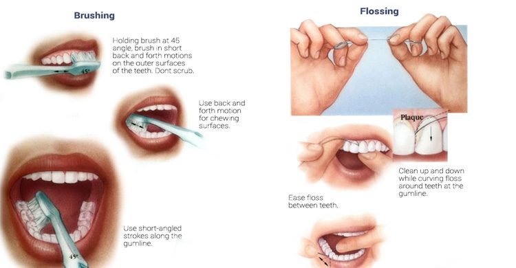 Proper Technique for Brushing and Flossing