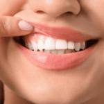 Keeping Your Gums Healthy