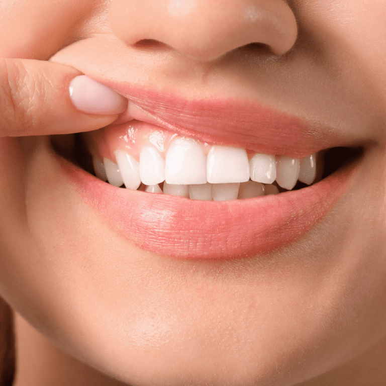 Keeping Your Gums Healthy