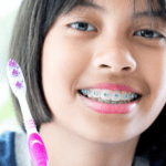 Top Picks: Best Toothbrush for Braces 2023