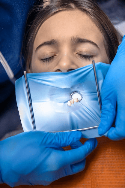 Understanding Emergency Root Canals