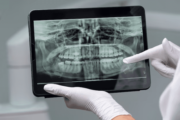 Importance of X-Rays