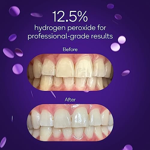 BURST Sensitive Teeth Friendly Whitening Kit | 3 Treatments with 12.5% Hydrogen Peroxide | Up to 3 Shades Whiter After First Use | Prefilled Gel Trays