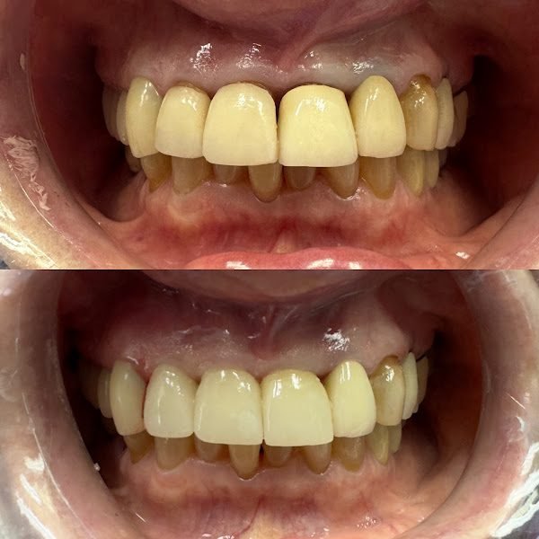 A&E Dental - Dentist in Floral Park 2