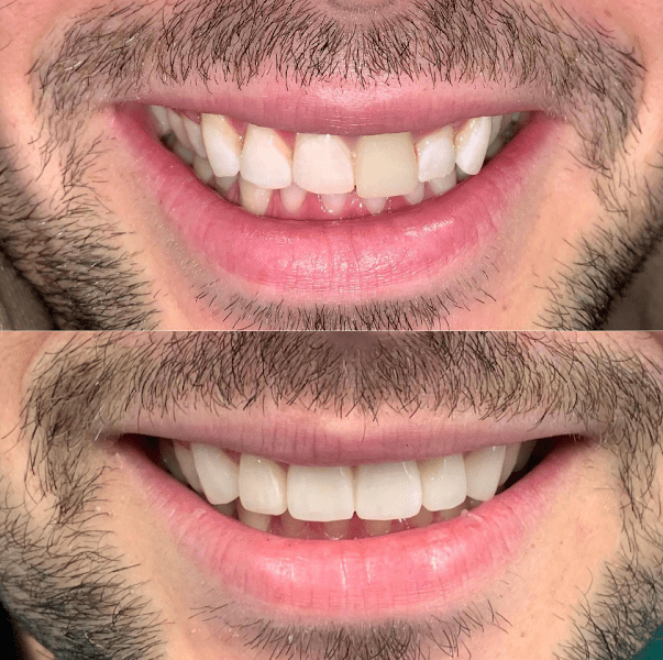 Advanced Dental Arts NYC 3