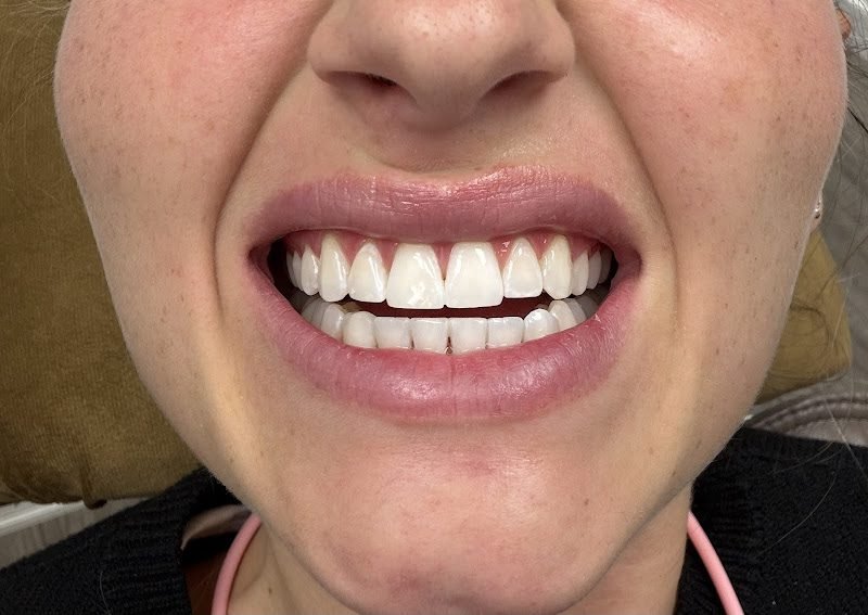 Aesthetic and Laser Dentistry of New York 2