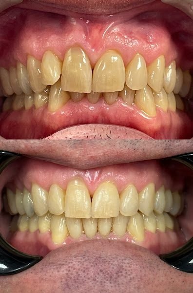 Apex Family Dental PC 5