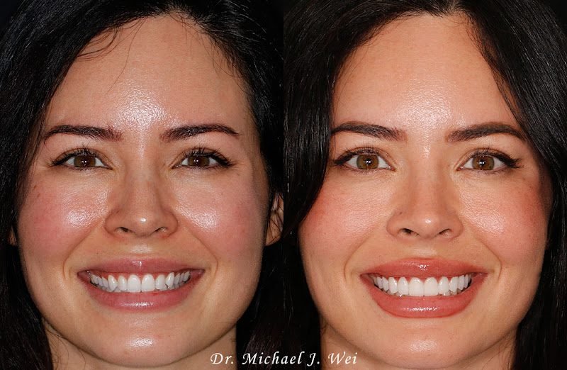 Cosmetic Dentistry Center NYC - Dr. Pia Lieb 3