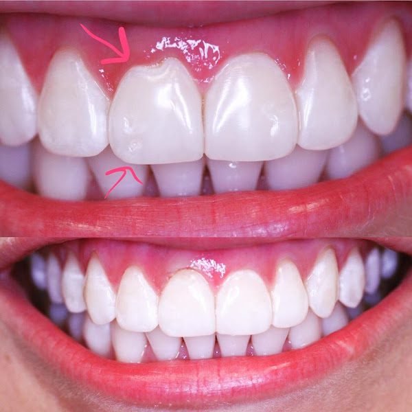 Dentist Upper East Side NYC 4