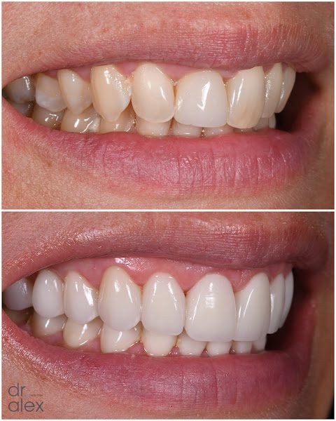 Dr. Alex Rubinov - NYC Cosmetic Dentist 5