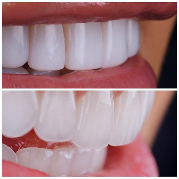 Empire Dental Aesthetics 4