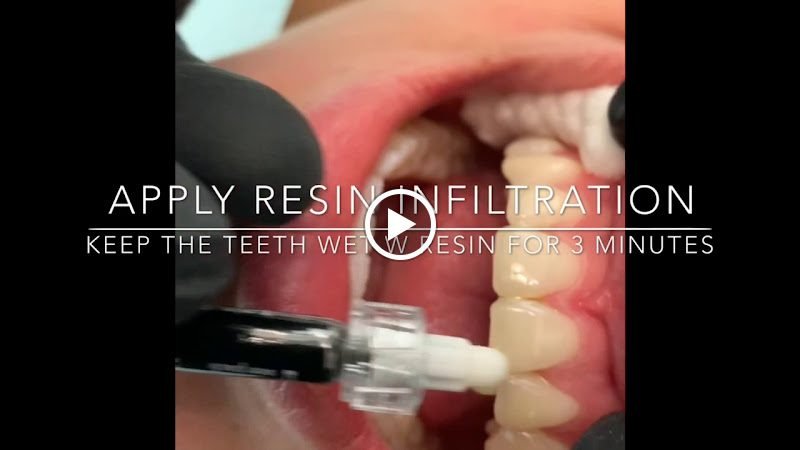 Joshua Perlman, D.M.D, NYC Smile Spa 2