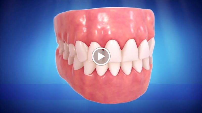Keith Bracy DDS Dentistry 3