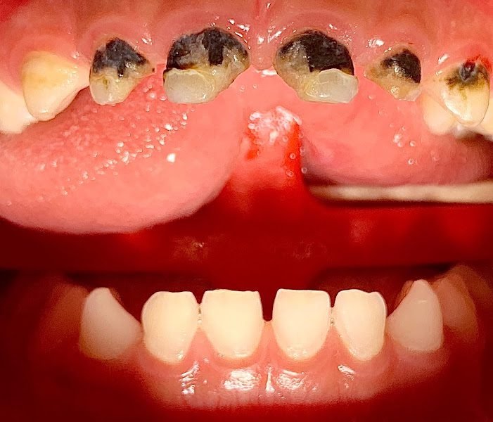 Little Grins Sedation Dentistry 2