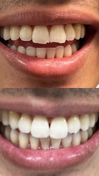 Luxury & Cosmetic Dentistry NYC 4