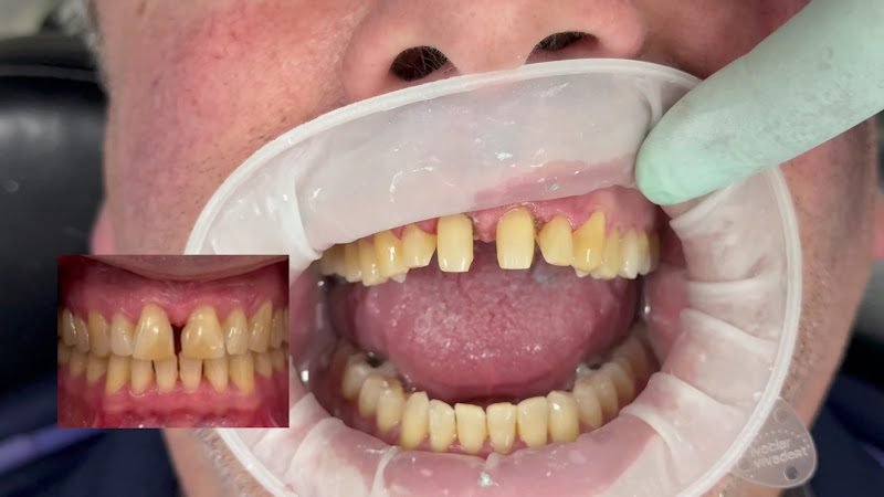 Manhattan Dental Spa: John Vargas DDS, Allison Gordon DMD, & Mitchell Charnas DMD 3