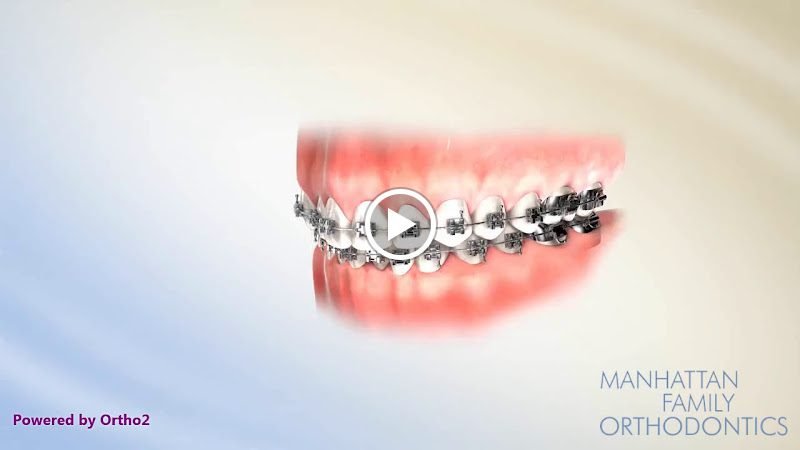 Manhattan Family Orthodontics-Uptown 2