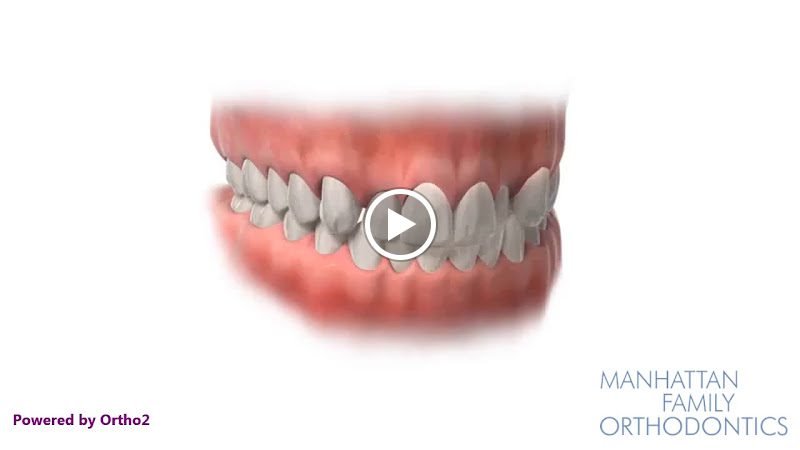 Manhattan Family Orthodontics-Uptown 3