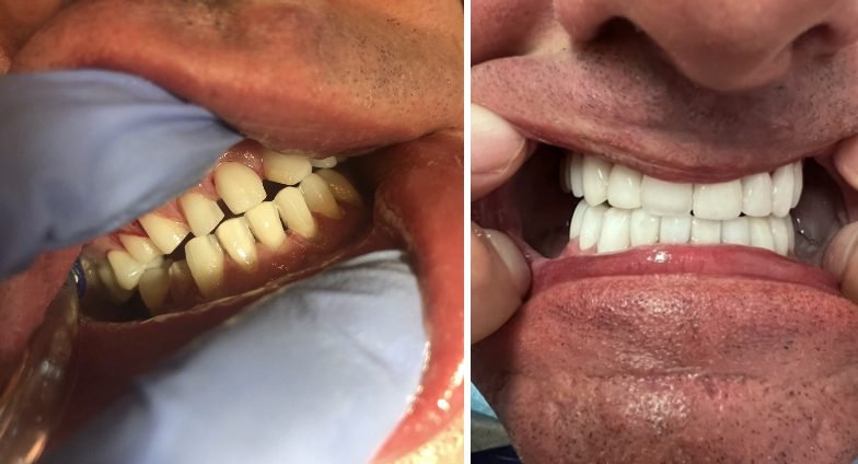 Smile Cafe Dental Spa 5