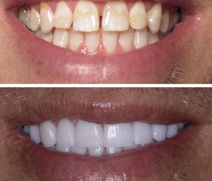 Smile Center of NY 2