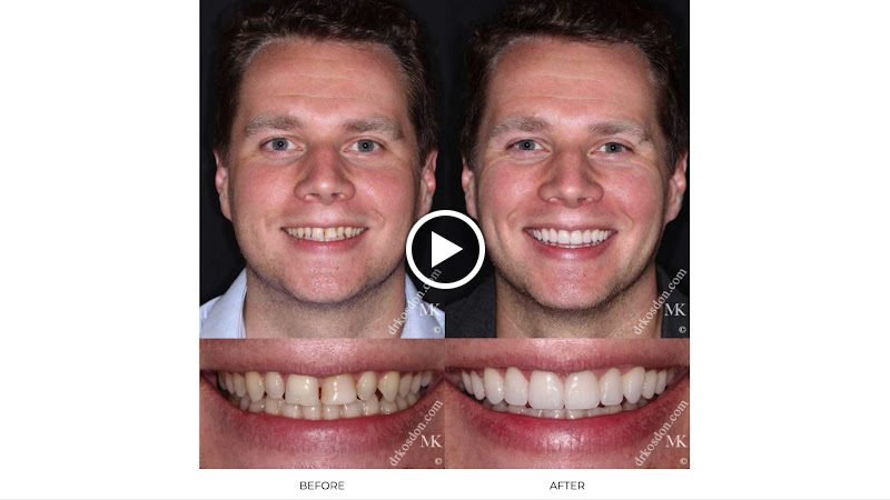 Smiles of NYC - Michael Kosdon DDS 2