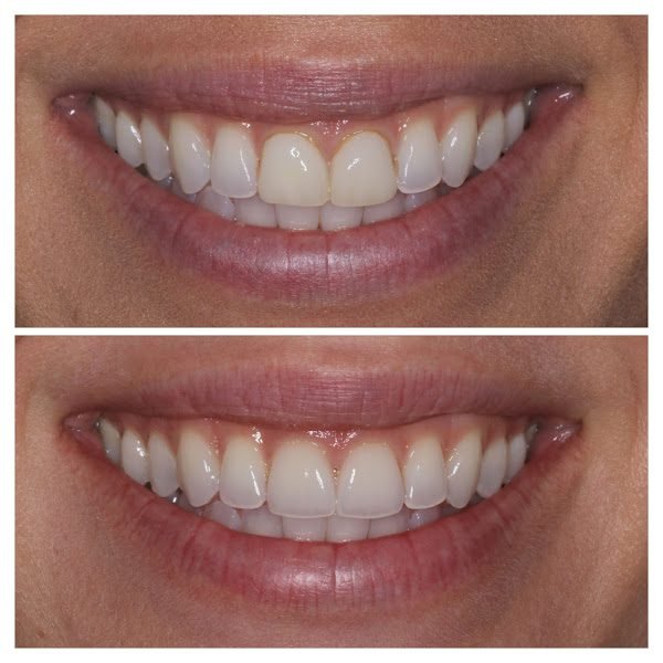 Smiles of NYC - Michael Kosdon DDS 3