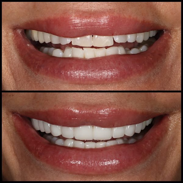 The New York Center for Cosmetic Dentistry 2