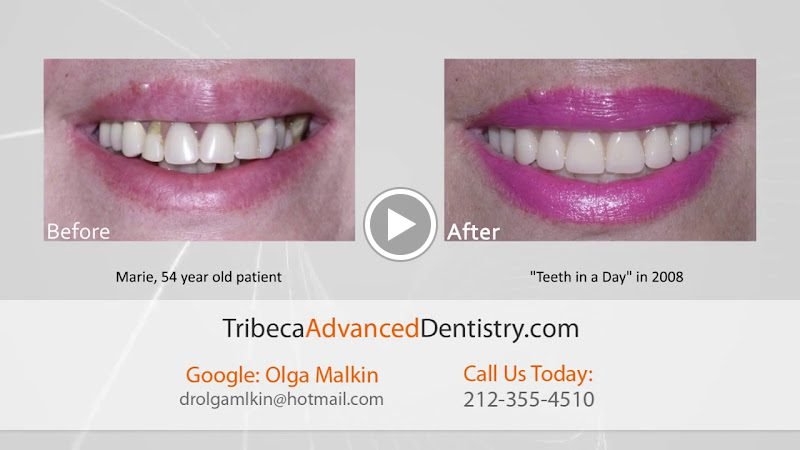 Tribeca Advanced Dentistry by Dr. Olga Malkin 2