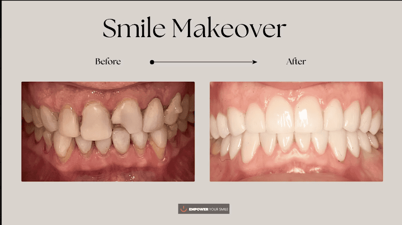 Tribeca Dentist - Empower Your Smile 2