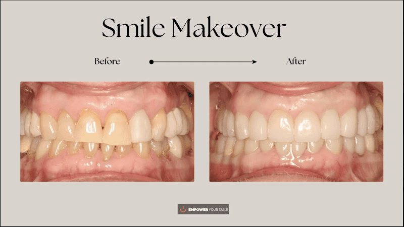 Tribeca Dentist - Empower Your Smile