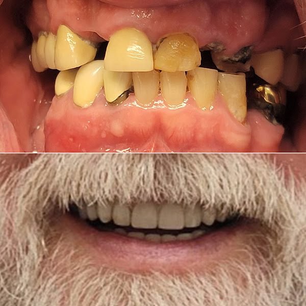 Advanced Dentistry & Implant Center