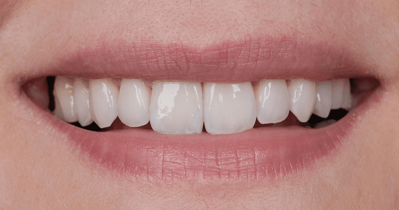 ArtLab Dentistry Brentwood