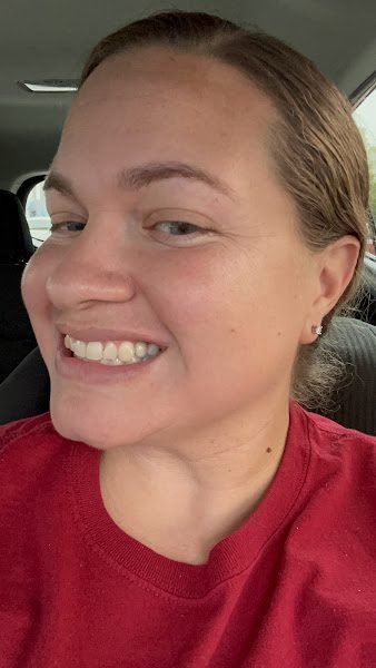 Bala Periodontics and Dental Implants