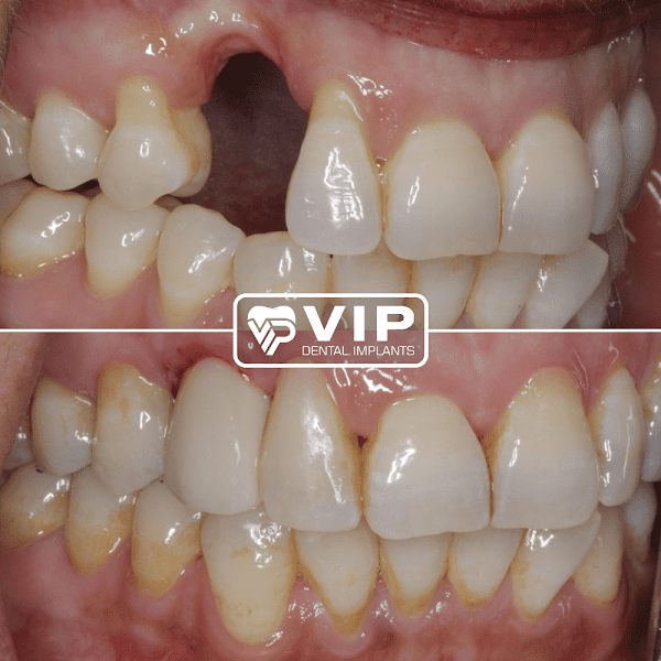 Barry W. Heaton DDS 5