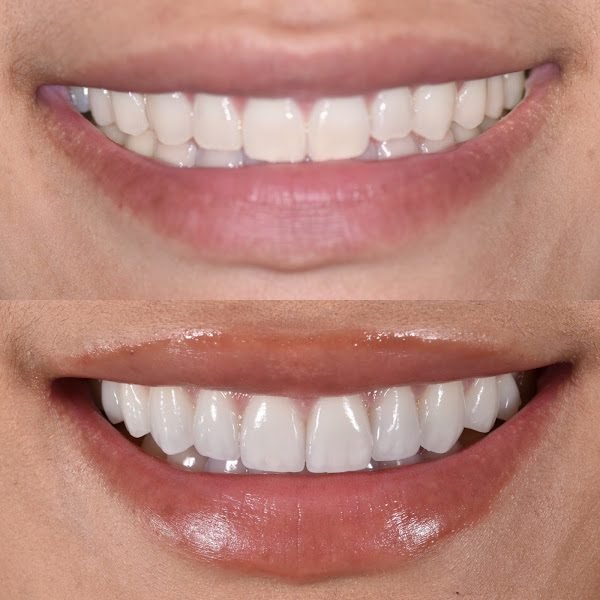 Beverly Hills Dentistry