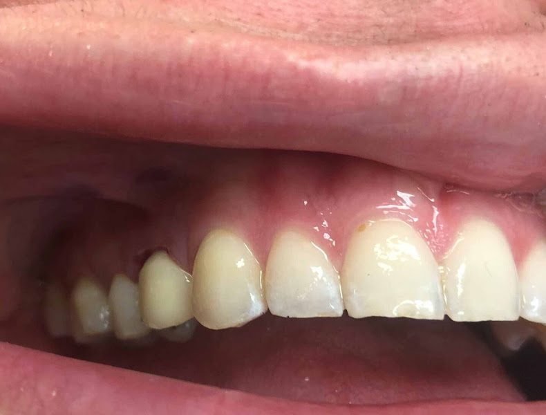 Beyond Dentistry Laser Center