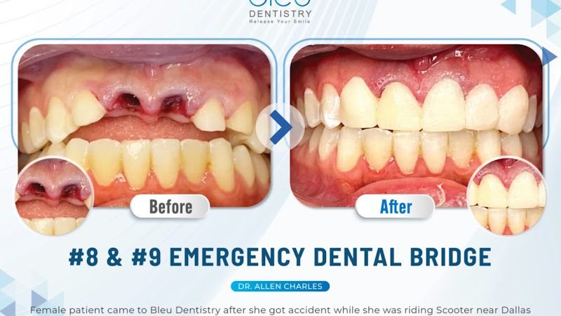 Bleu Dentistry