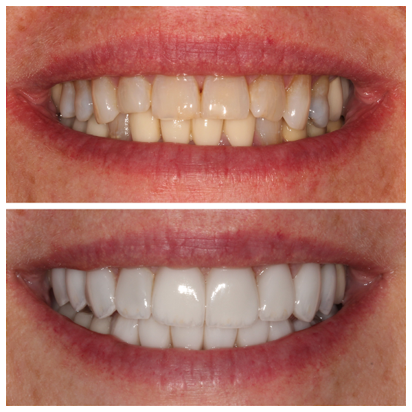 Bright Smile Dental of Brooklyn 3