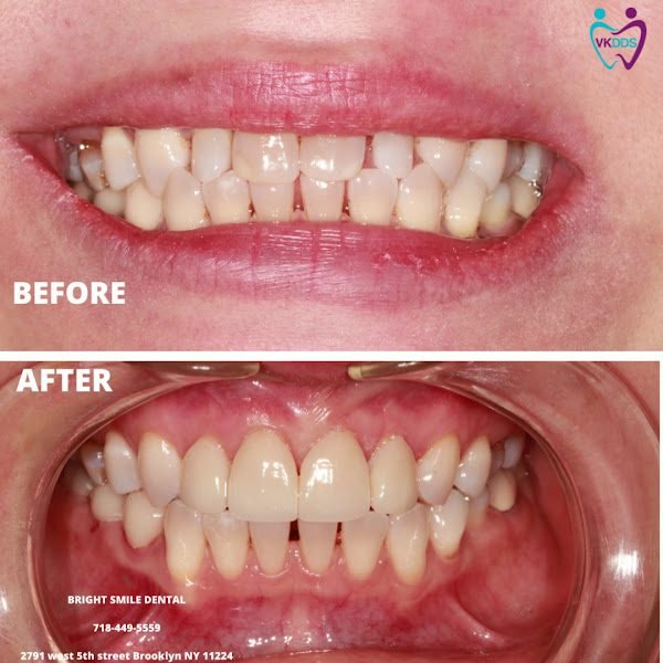 Bright Smile Dental of Brooklyn 4