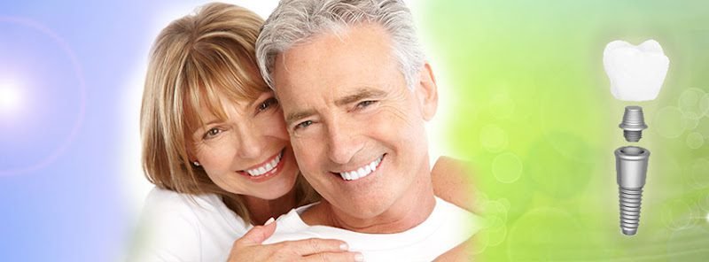 Dental Implants Specialist Los Angeles 4