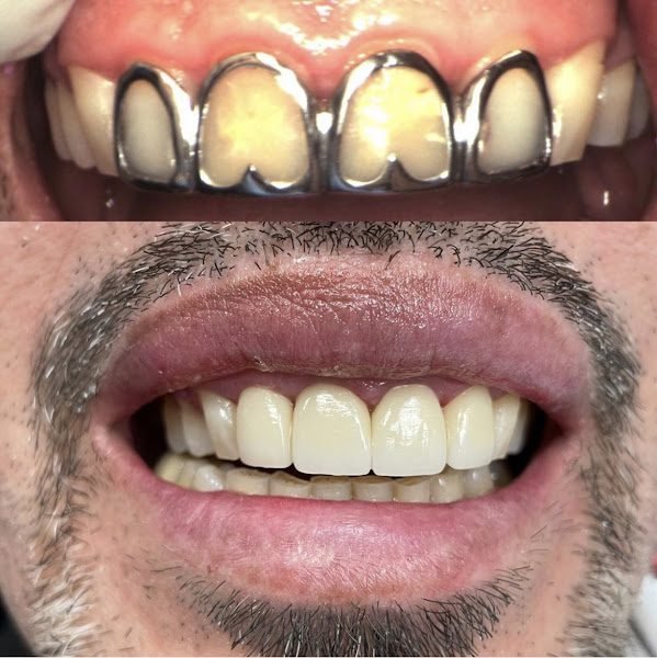 Dental and Implant Care Center