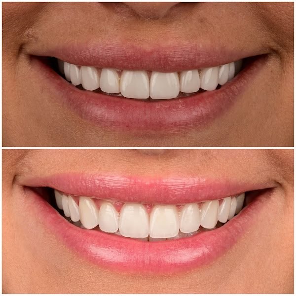 Dr. Borzoo Ahmadi DDS - Cosmetic Dentist