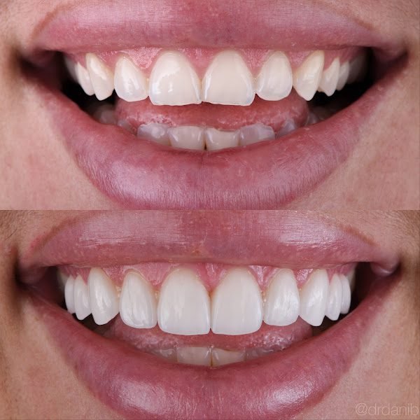 Dr. Dani Benyaminy, DDS