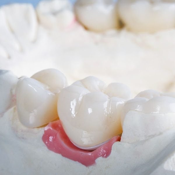 Emergency Dentist Midtown