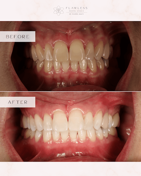 Flawless Dental Studio