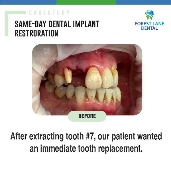 Forest Lane Dental of Northwest Dallas