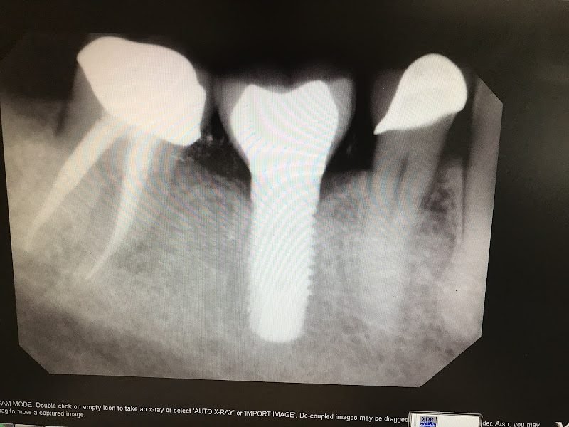 Implant Dentist of LA 3