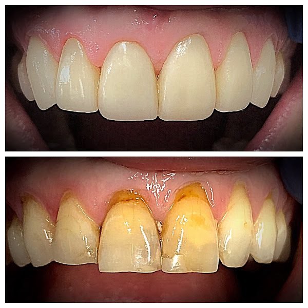 Implant Dentist of LA