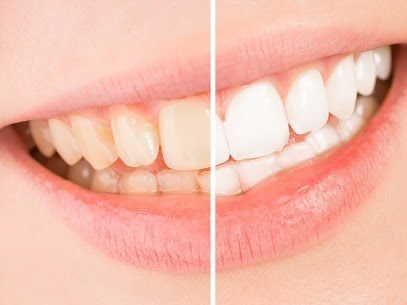 LA Holistic Dental Group 4