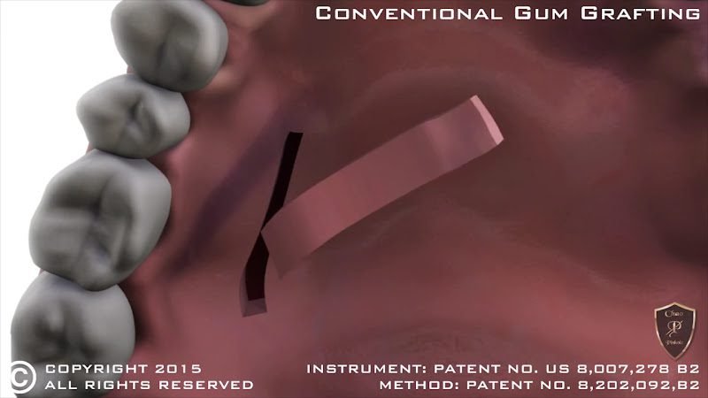 La Jolla Dental Implants & Periodontics 2